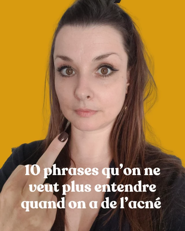 Tu les connais, ces phrases, hein ?
Celles qui t’enfoncent un peu plus quand tu fais déjà tout pour t’en sortir.

L’acné, ce n’est pas une question de volonté.
Ni de crème magique.
Ni d’un conseil balancé à la va-vite pendant un apéro.

C’est un message.
Un signal de ton corps.
Et ça demande d’être entendu (pas commenté).

🧠 C’est exactement ce qu’on va voir ensemble dans ma masterclass de lundi :
Les 3 vérités sur l’acné hormonale qui t’empêchent de la résoudre durablement.
📅 Lundi 26 mai – 20h30
📍 Sur Zoom
⚡ Lien en bio

Tu viens ? 

Alexandra 💜
__________
#santedelapeau #soindelapeau #dermatillomanie #hypersensibilité #acné #acnee #introvertie #anxieuse #anxiété #acnéhormonale #acnehormonale