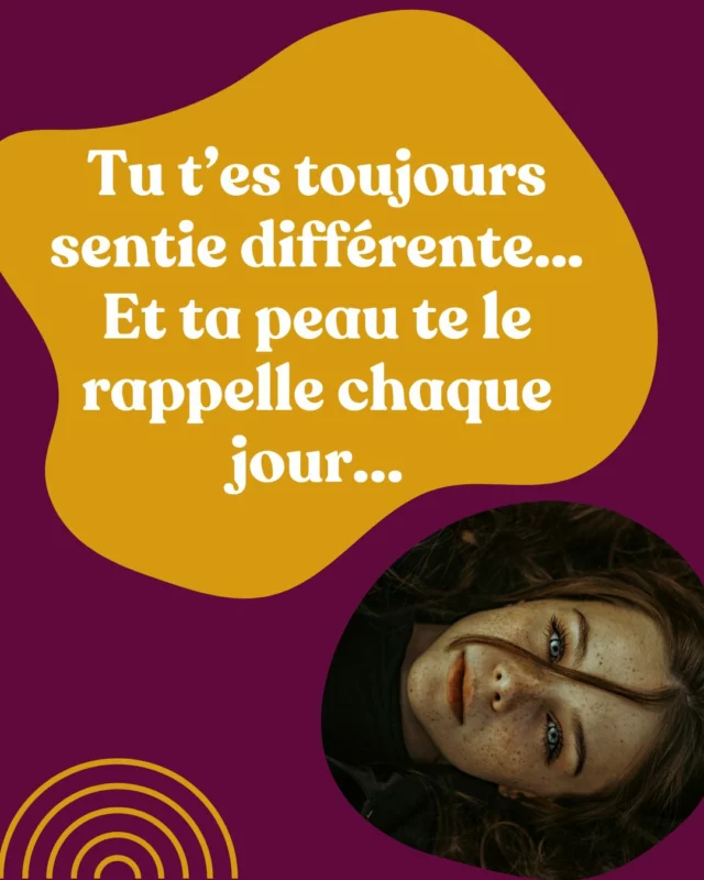 💭 Tu t’es toujours sentie à part.

Pas vraiment marginale… Mais jamais vraiment à ta place non plus.

Pas faite pour les mondanités, les conventions, les groupes où il faut briller et rentrer dans les cases.

Toi, tu ressens. Fort. Profondément.
Et parfois…Douloureusement.

Et ça, ton corps le sait.
Ta peau aussi.

Ce que beaucoup appellent "acné hormonale" chez la femme adulte, moi je le vois autrement. 
Comme un message. Un cri. Un déséquilibre plus vaste qui touche à tout ce que tu es :

✨ "hyper"sensibilité,
✨ système nerveux à bout,
✨ hormones en pagaille,
✨ fatigue mentale et corporelle,
✨ tension intérieure permanente...

Tu n’es pas “trop compliquée”.
Tu es juste faite autrement. 

Et c’est spécifiquement ces femmes que j’accompagne chez The Good Balance. 

Pas avec des crèmes.
Pas avec des soins miracles. 
Pas avec des régimes.
Mais avec une méthode en profondeur qui reconnecte ton corps, ton mental et tes émotions.

👉 Les portes de mon programme Hack ta Peau sont ouvertes jusqu’à lundi.

💌 Tu veux en savoir plus ?
Écris-moi “Hack” en message privé ou en commentaire et on voit ensemble si c’est pour toi.

Avec douceur et détermination,
Alexandra 💜
__________
 #acné #acnéhormonale #acnesolution #hypersensible #anxieuse